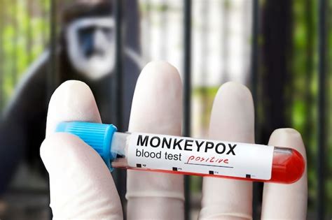 Images de Poxvirus – Téléchargement gratuit sur Freepik