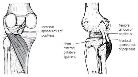 Popliteal Tendonitis - Paragon Orthotic Laboratory