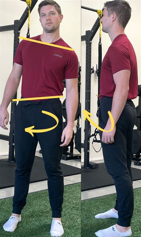 A Comprehensive Guide To Fixing Lateral Pelvic Tilt