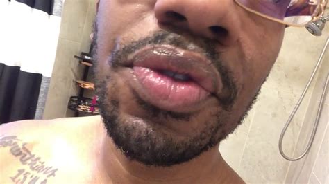 Black Man Minoxidil Beard Journey Day 1 Youtube