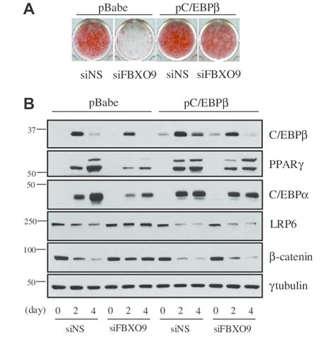 C Ebpb Overexpression Remarkably Alleviates The Inhibition Of