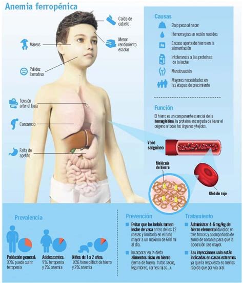 C Mo Saber Si Mi Hija Tiene Anemia Mibbmemima