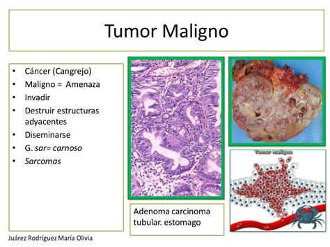 Caracteristicas De Las Neoplasias Benignas Y Malignas