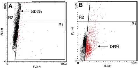 Representative Histograms Of Sperm Chromatin Structure Assay SCSA