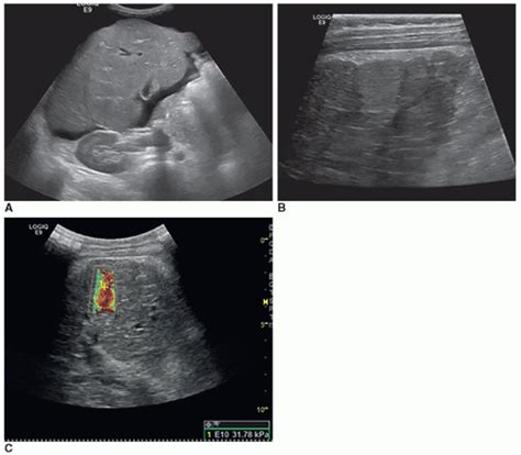 The Pediatric Abdomen Radiology Key