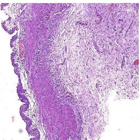 Glass Transitional Epithelium Histology Slide, For teaching in medical ...