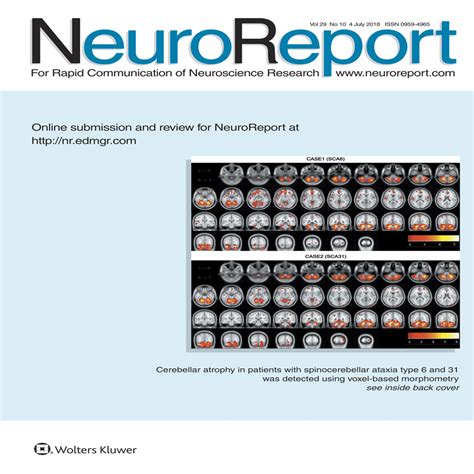 Sex Differences In A Chronometric Mental Rotation Test With