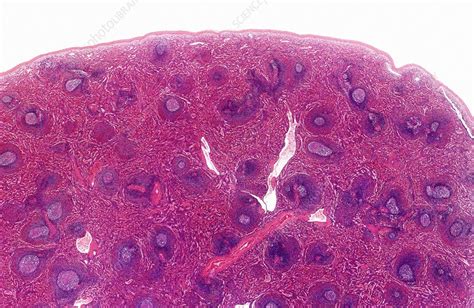 Spleen Light Micrograph Stock Image C024 0098 Science Photo Library