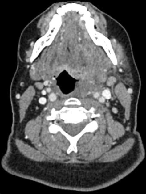 Contrast‐enhanced Computed Tomography Ct Imaging Demonstrating A Soft Download Scientific