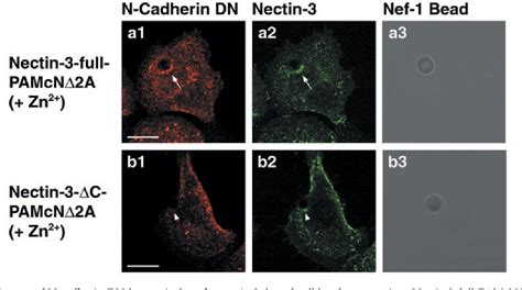 Figure 4 From Role Of Nectin In Formation Of E Cadherin Based Adherens