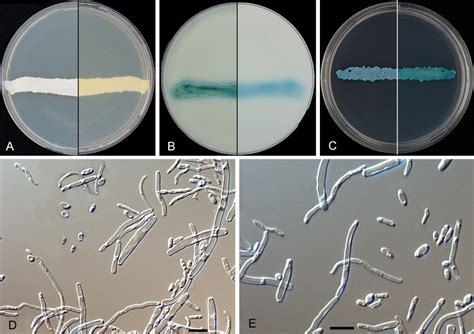 Diutina Catenulata Atlas Of Clinical Fungi