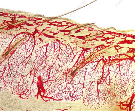 Human scalp, injected blood vessels, light micrograph - Stock Image - C052/6770 - Science Photo ...