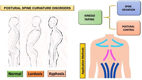 Jfmk Free Full Text A Short Overview Of The Effects Of Kinesio