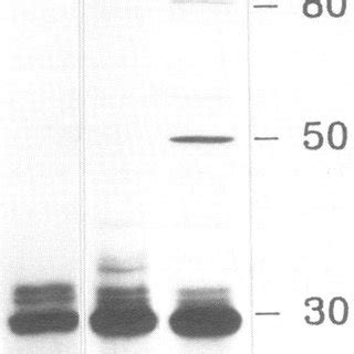 Autoradiography Of 35S Labeled Crude Cell Lysates Of E Coli Minicells