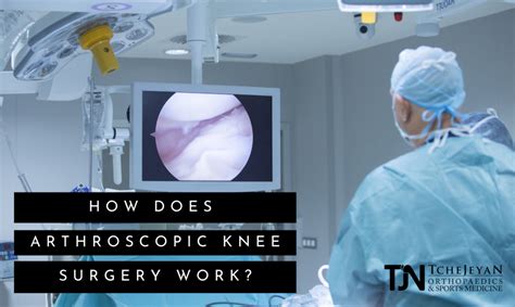 What Is Arthroscopic Surgery Tjn Ortho