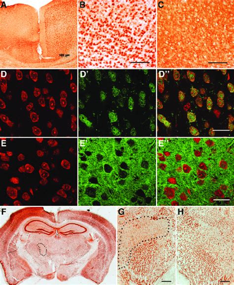 A E Frozen Lm Thick Sections Of Mouse Brain Days Post Injury