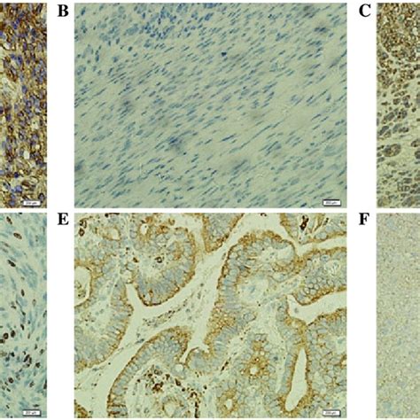 Immunohistochemistry Of CD133 CD117 And Ki67 Proteins In GIST And The