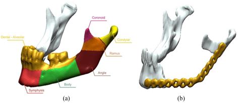 View Of A Lateral Mandibular Condyle A Mandibular Area And B