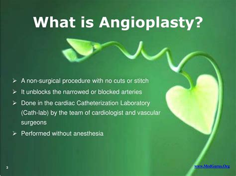 Ppt Facts On Angioplasty Powerpoint Presentation Free Download Id