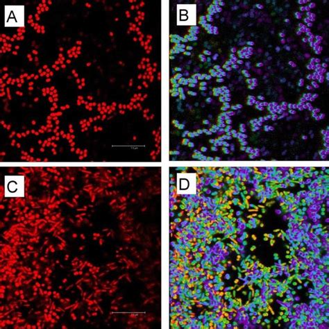 Confocal Laser Scanning Micrographs Of P Fluorescens After Incubation