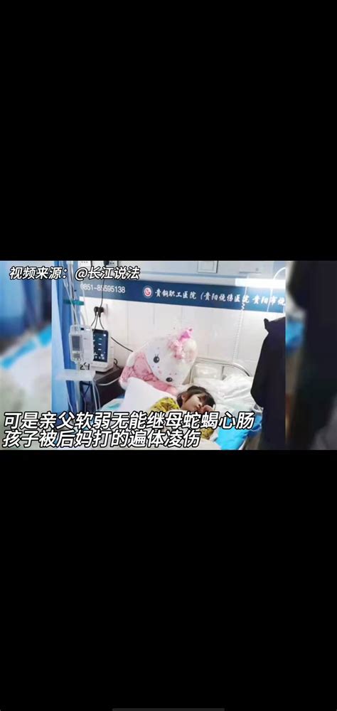 4岁女孩被后妈打的遍体鳞伤双脚疑被后妈严重烧伤 搜狐大视野 搜狐新闻