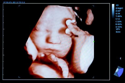 4d Ultrasound What It Is And When To Do It