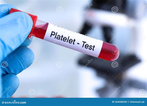 Platelet Test To Look For Abnormalities From Blood Stock Image Image