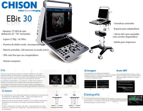 Chison Ebit Portable Ultrasound Machine Fisaude Store