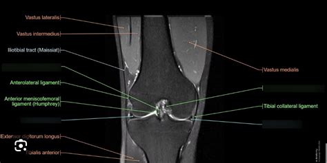 BIO 446L Lab 7 Identify The Major Structures Of The Knee Joint On An