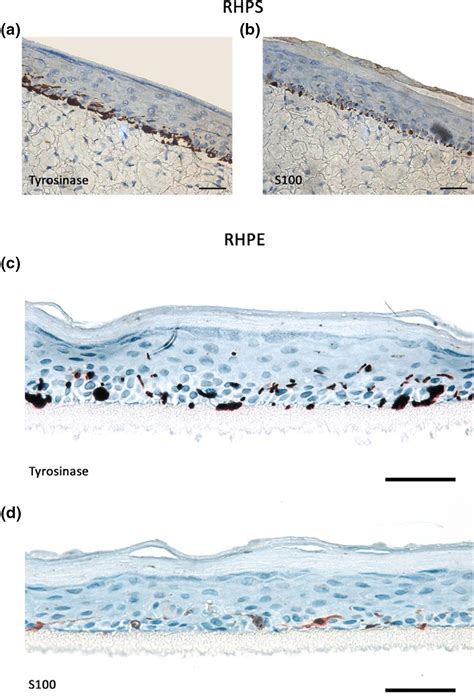 Reconstructed Human Pigmented Skin Epidermis Models Achieve Epidermal