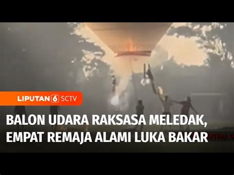 Balon Udara Raksasa Meledak Saat Diterbangkan Empat Remaja Terluka