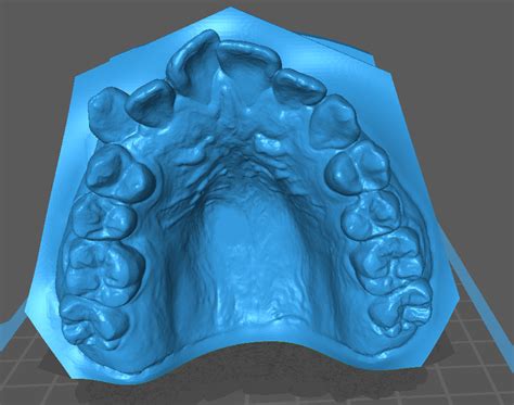 Fichier STL Modèle dentaire Design pour imprimante 3D à télécharger