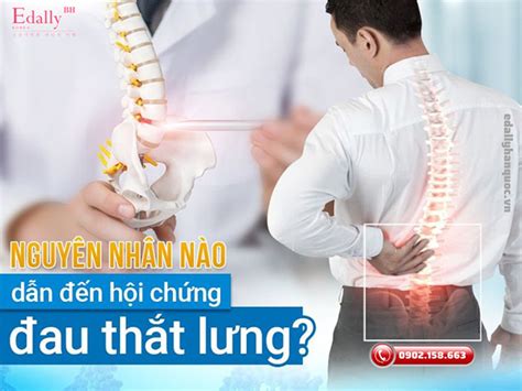 Nguyên Nhân Nào Dẫn Đến Hội Chứng Đau Thắt Lưng Ở Phụ Nữ Và Nam Giới