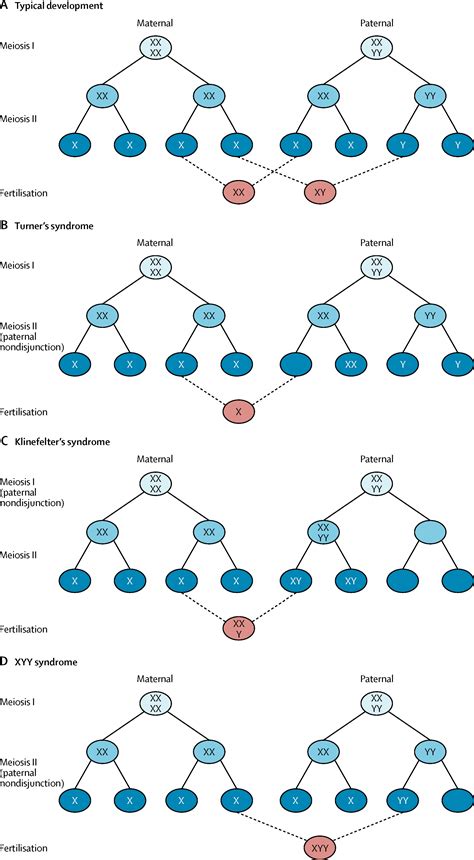 Klinefelter Syndrome Chromosome