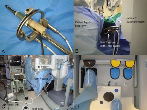 Robotic Transrectal Ultrasonography During Robot Assisted Radical