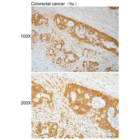 Solarbio K112119P Anti MYO1D Polyclonal Antibody 试剂仪器耗材