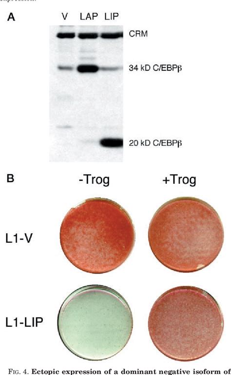 Figure 4 From A Role For Cebpβ In Regulating Peroxisome Proliferator