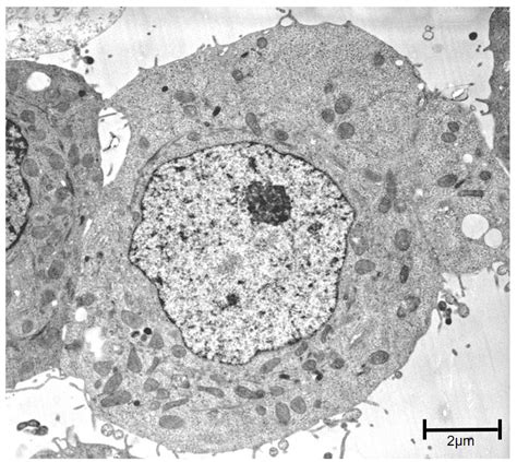 Eukaryotic Animal Cell Electron Micrograph