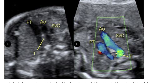 Figure 8 Cardiac Sonography Obstetric Ultrasound Magnetic Resonance