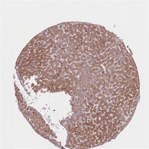 Tissue Expression Of Laptm Staining In Liver The Human Protein Atlas