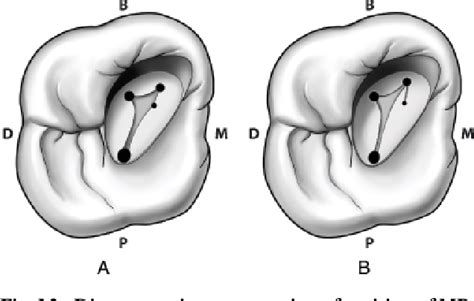 [PDF] Root canal morphology and its relationship to endodontic procedures | Semantic Scholar