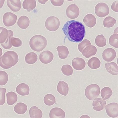 Target Cells Haematologyetc Co Uk