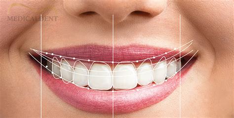 Smile Design Medicaldent