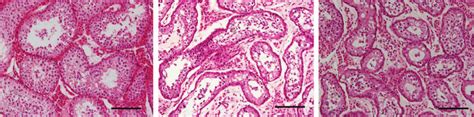 Histological Appearance Of Testis Tissues Weeks After Treatment From