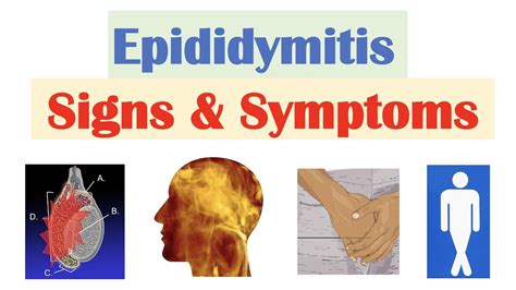 epididymitis scrotal pain signs symptoms   occur youtube