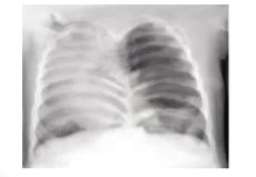 Image Based Questions On Respiratory System