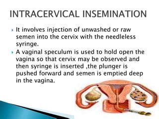 Artificial Reproductive Technology Ppt