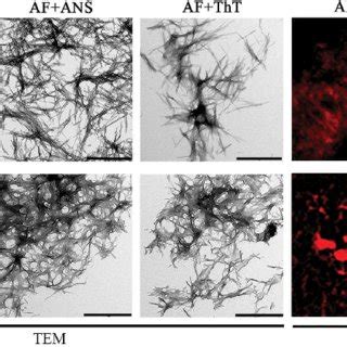 Morphology and staining by fluorescent probes of amyloid fibrils formed ...