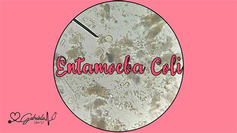 Entamoeba Coli Alicia En Medicina By Gabriela Soplin Villacorta Udocz