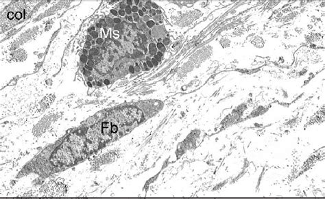 Electron Micrograph Of Fibroblast Fb Collagen Fibres Col In The